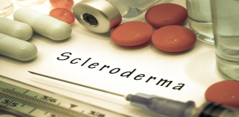 Scleroderma-14-06-24
