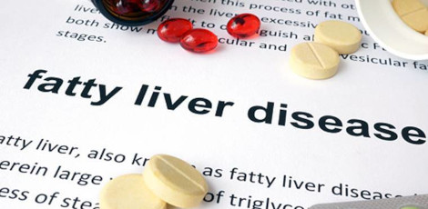 Subtle changes in hands that will reveal liver disease or liver damage in us!!